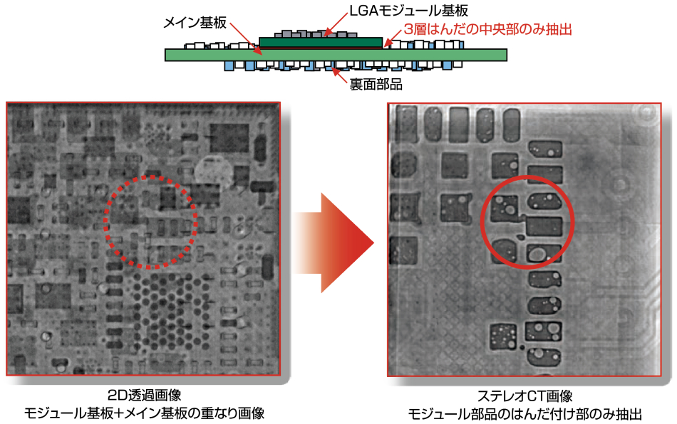 アイビットのX線ステレオ方式＋ステレオCT方式